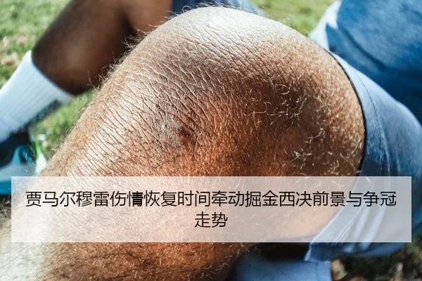 贾马尔穆雷伤情恢复时间牵动掘金西决前景与争冠走势 - kaiyun